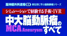 中大脳動脈瘤(MCA Aneurysm)のすべて シミュレーションで経験する手…