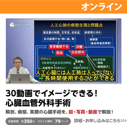 30動画でイメージできる！心臓血管外科手術